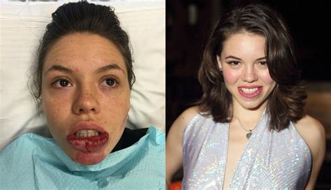 celina smith plastic surgery.